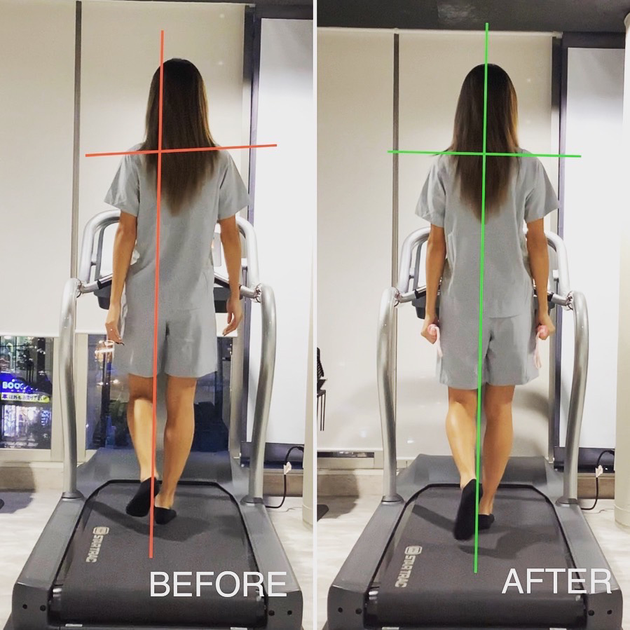 APEX　アライメント調整